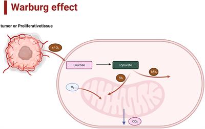 Alterations in cellular metabolism under different grades of glioma staging identified based on a multi-omics analysis strategy